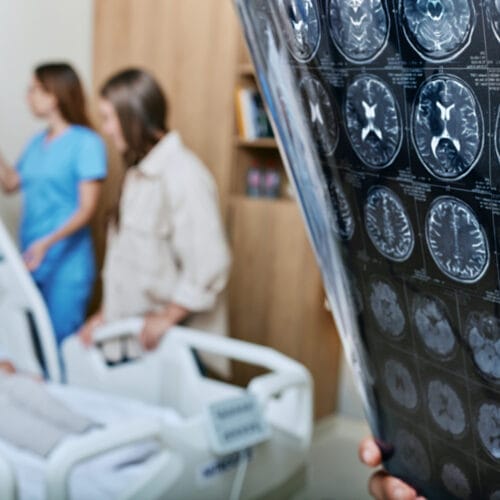A doctor examines brain scan images while a stroke patient lies in a hospital bed, accompanied by a nurse and family member.